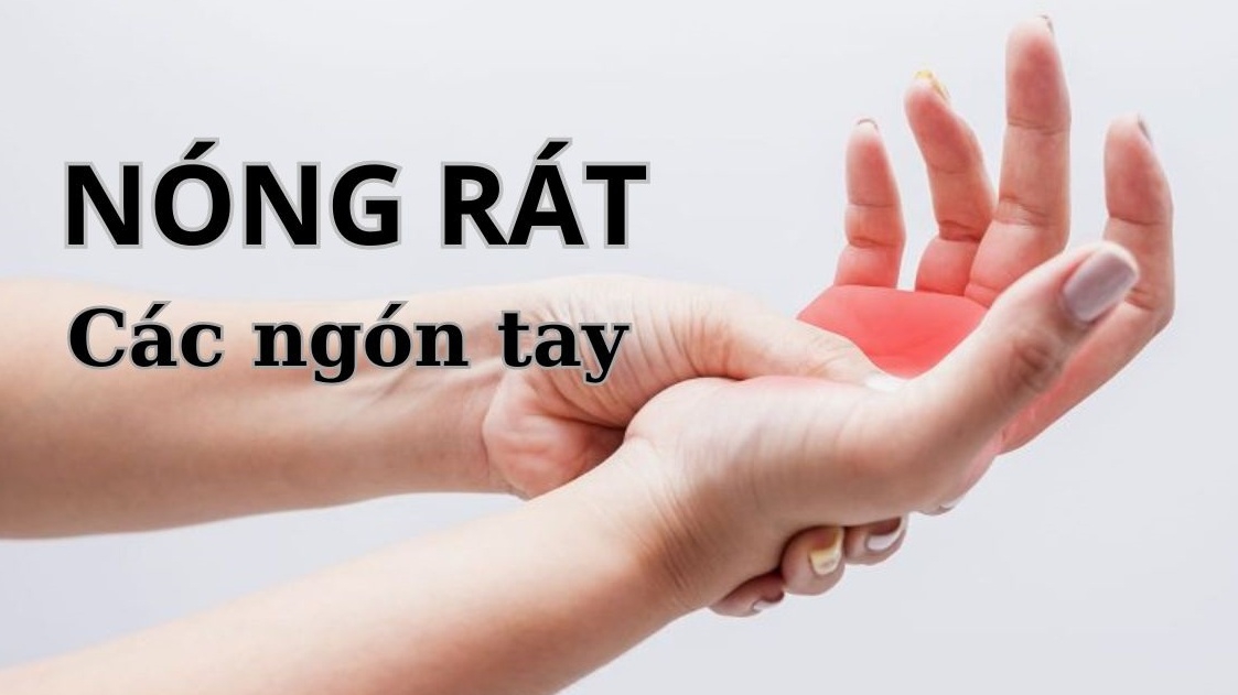 Ngón tay bị nóng rát lá dấu hiệu cảnh báo điều gì?