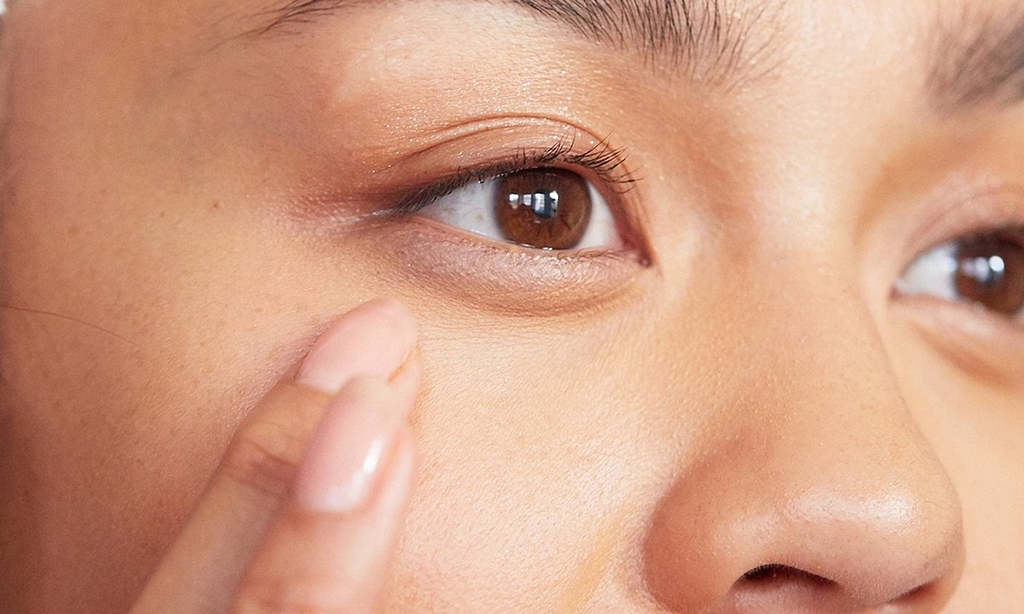 Có cách nào khắc phục bọng mắt sưng nhanh chóng không?

