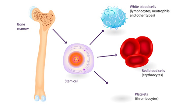 Người bệnh ung thư máu giai đoạn 3 sống được bao lâu? 3