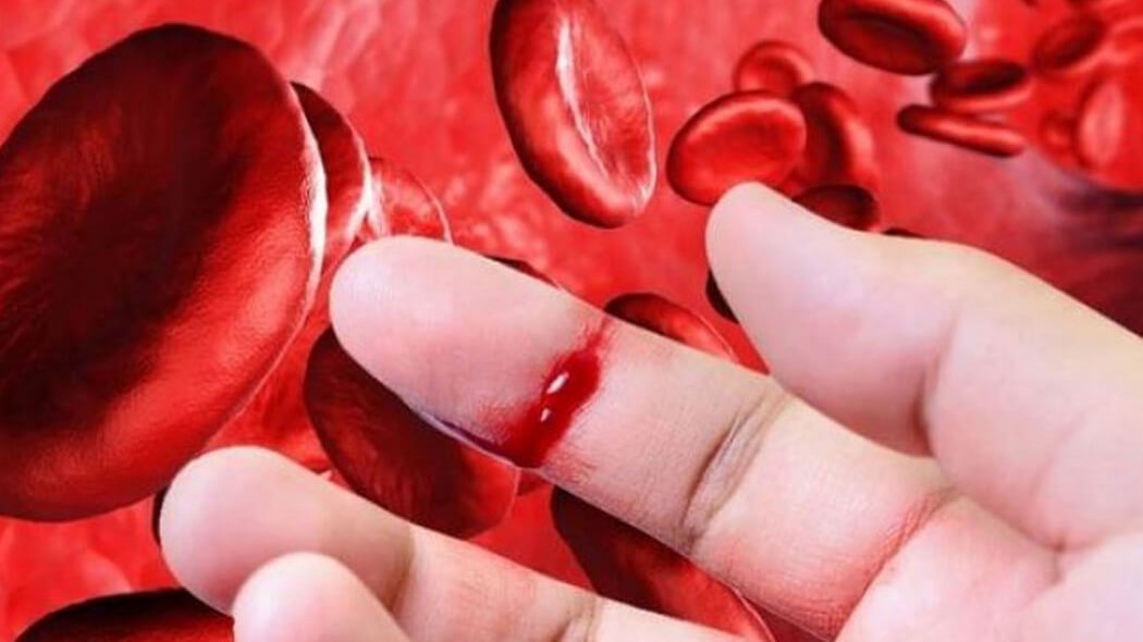 Ômega-3 có lợi ích gì đối với người bị máu khó đông?
