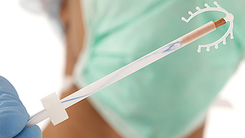 Theo đánh giá của các chuyên gia, tác dụng của vòng tránh thai có thể bị giảm sau bao lâu sử dụng?
