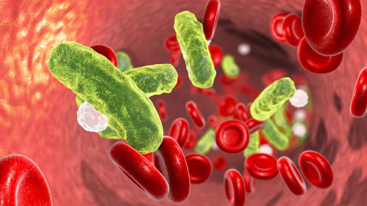 Ai là nhóm nguy cơ cao mắc bệnh nhiễm khuẩn máu ở trẻ em?
