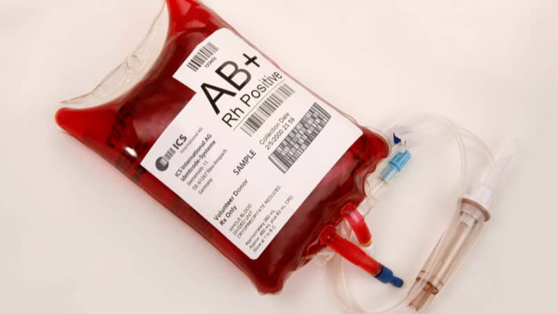 Những yếu tố nào khác ngoài nhóm máu cần được xem xét trong việc truyền máu cho nhóm máu AB?
