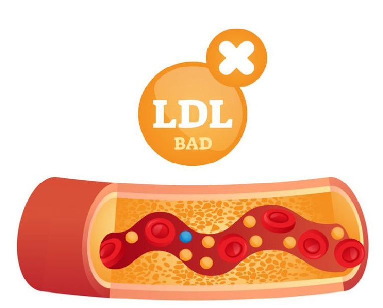 Những điều cần biết về chỉ số LDL cholesterol trong máu 1