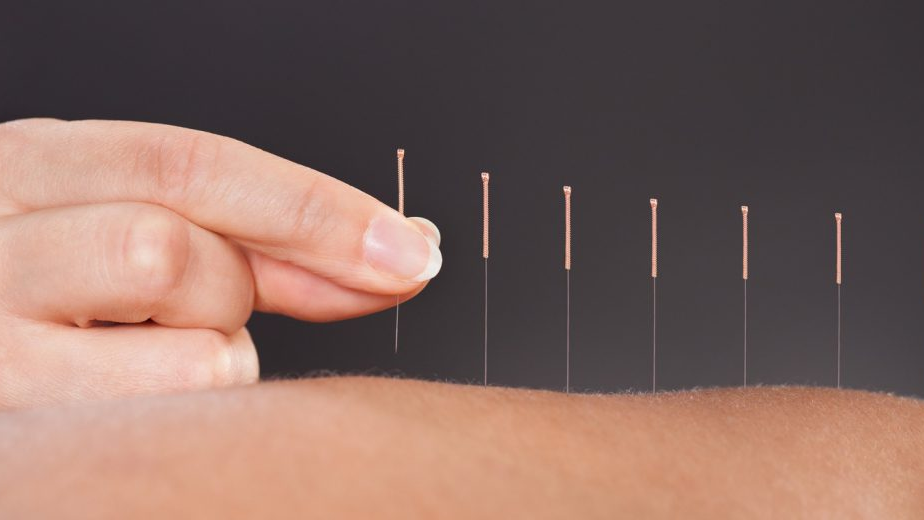 Những kiến thức thú vị về y học cổ truyền mà bạn nên biết