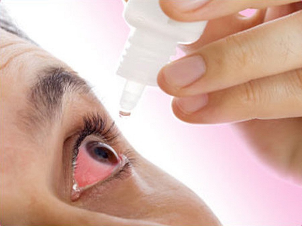 Thời gian dùng thuốc chữa đau mắt đỏ hiệu quả nhất là bao lâu?
