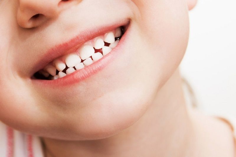 Những lưu ý về giai đoạn răng hỗn hợp ở trẻ 2