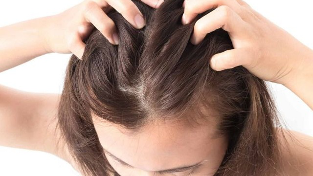 Nhức da đầu là triệu chứng gì?
