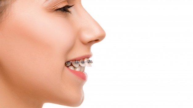Răng hô làm môi dày xảy ra do nguyên nhân gì?
