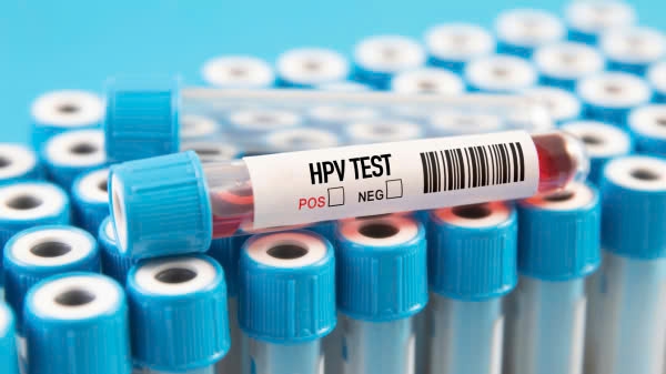 NIH dẫn đầu nghiên cứu để thử nghiệm sàng lọc HPV và ung thư cổ tử cung tại nhà