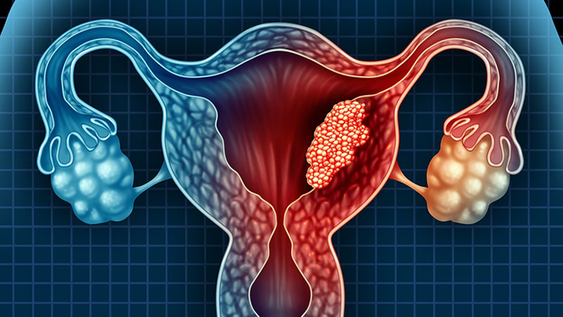 Nội mạc tử cung là gì? Chức năng và các bệnh lý thường gặp của nội mạc tử cung 4