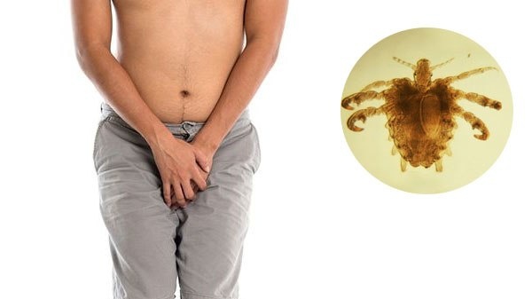 Rận mu có khác gì so với các loại ký sinh trùng khác trên cơ thể nam giới?

