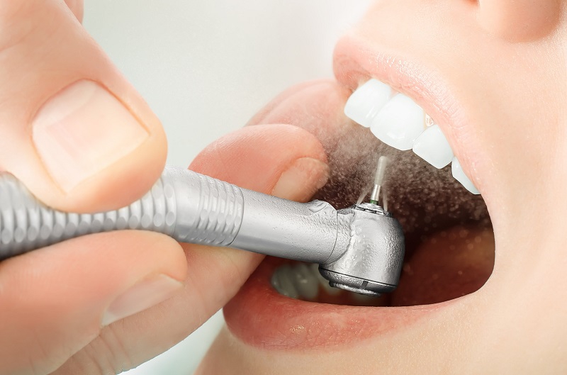  Mài răng xong bị ê buốt : Nguyên nhân và cách khắc phục