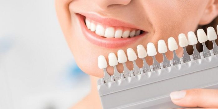 Làm thế nào để phòng ngừa viêm tủy cho răng bọc sứ?
