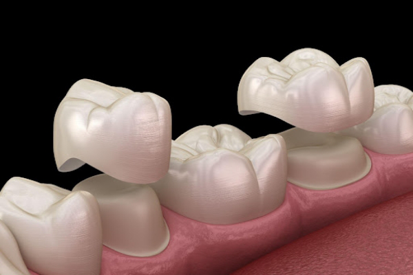 Răng hàm bị vỡ có nguy hiểm không? 3