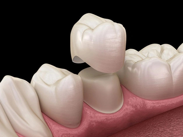 Răng sâu nên làm gì? 4