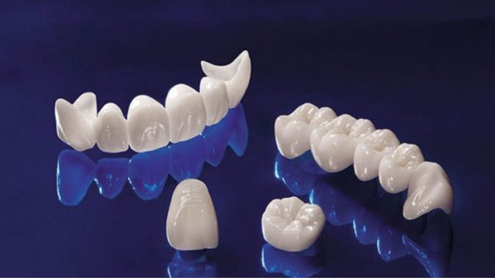 Răng sứ Ceramill: Ưu, nhược điểm và phân loại