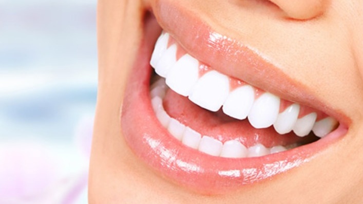 Răng sứ pha lê có tốt không? Có bền không? 1