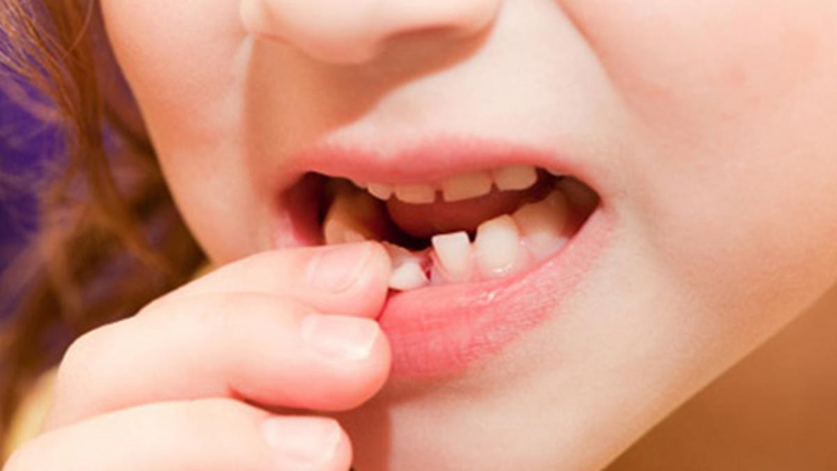 Làm thế nào để tăng cường quá trình rụng răng sữa?
