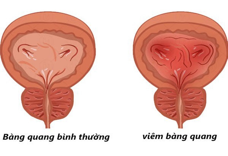 [Hỏi & Đáp] Rau đắng có tác dụng gì? 3