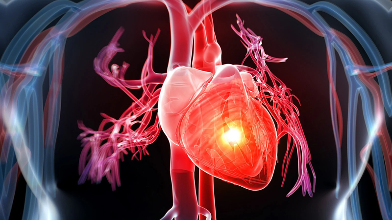 Rối loạn nhịp tim nhanh trên thất: Nguyên nhân và cách điều trị hiệu quả 1