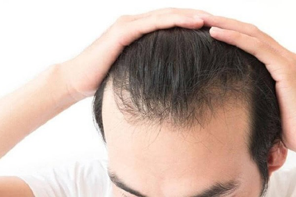 Nguyên nhân rụng tóc và cách kích thích mọc, phục hồi tóc hư tổn