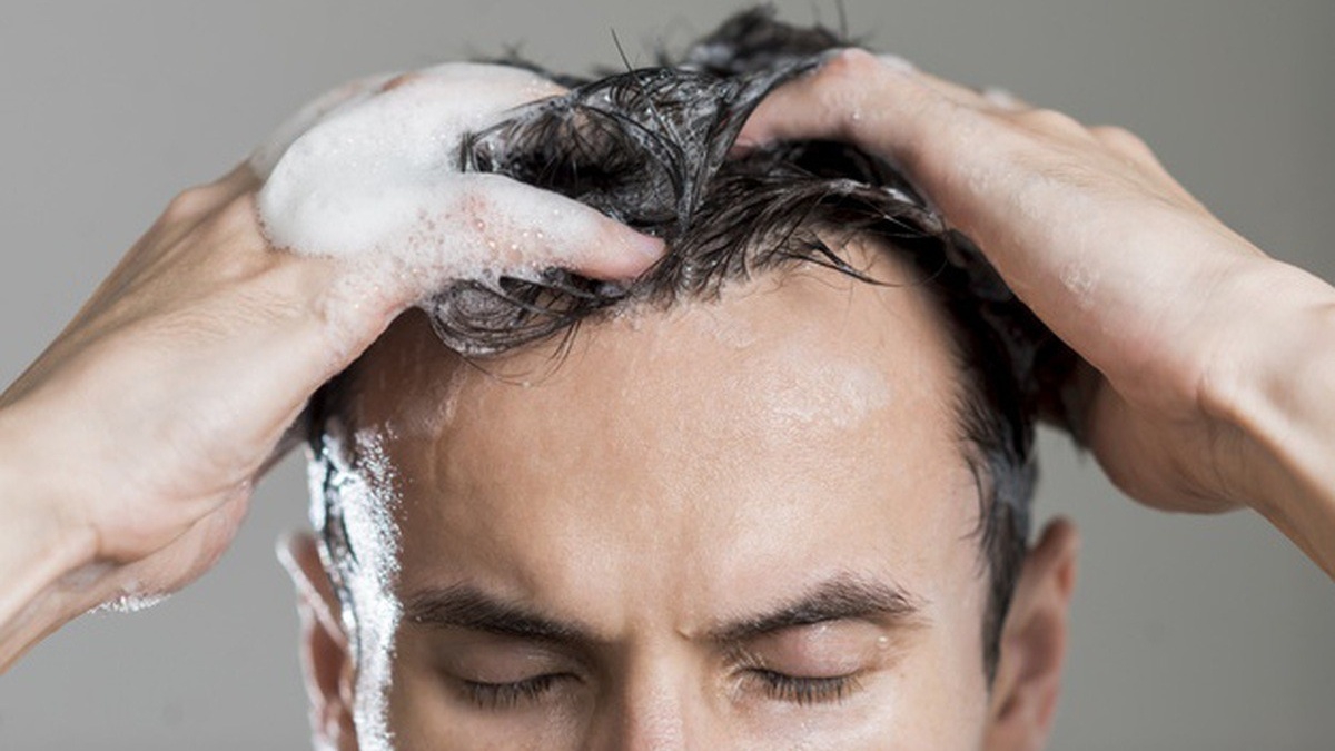 Những điều bạn cần biết về bệnh rụng tóc ở nam giới - Phòng khám Maia
