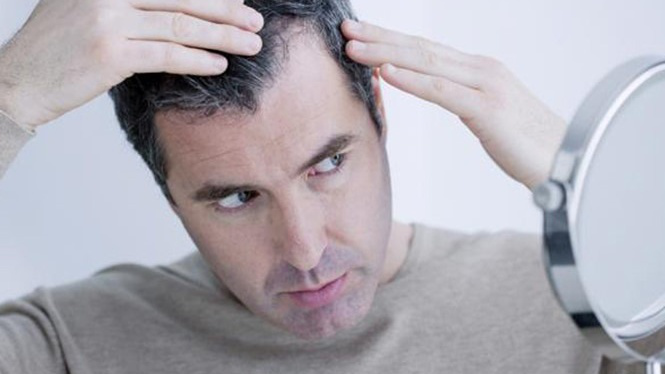 Rụng tóc ở nam giới tuổi 30 do đâu Cách khắc phục  Nhà thuốc FPT Long Châu