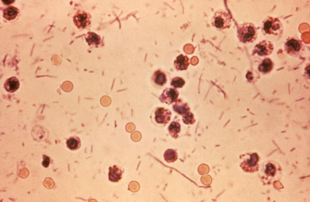 shigella-shigae-nguyen-nhan-dieu-tri-va-cach-phong-ngua 1.jpg