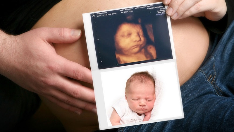 Siêu âm hình thái tuần 21-24 có thể giúp phát hiện những bất thường về hình dạng của thai nhi?
