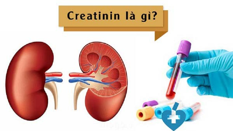 Sinh hóa creatinin máu là gì? Nồng độ creatinin bao nhiêu là bình thường?