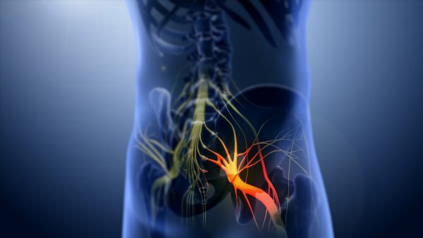 Đau cơ mông là gì? Tìm hiểu các phương pháp điều trị đau cơ mông do căng cơ 5