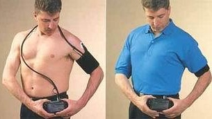 Holter huyết áp là gì? Ưu điểm của Holter huyết áp