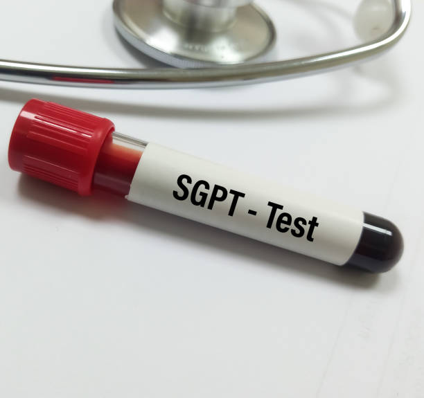 Hướng dẫn đọc kết quả xét nghiệm SGPT