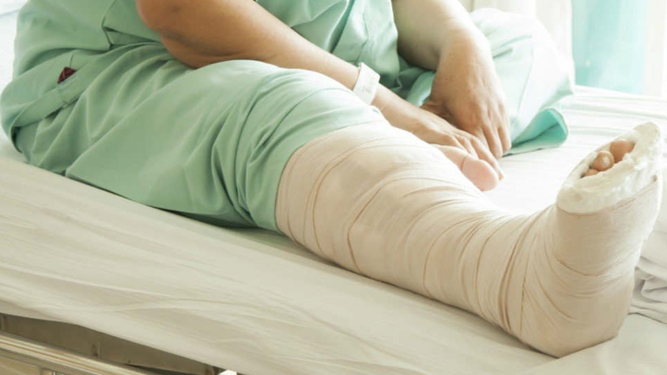 How to perform first aid and bandage for a broken bone?