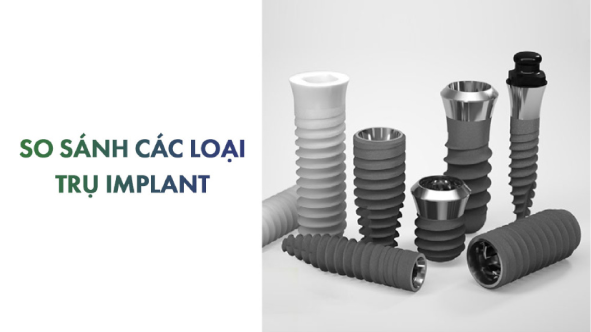 So sánh các loại trụ Implant phổ biến hiện nay