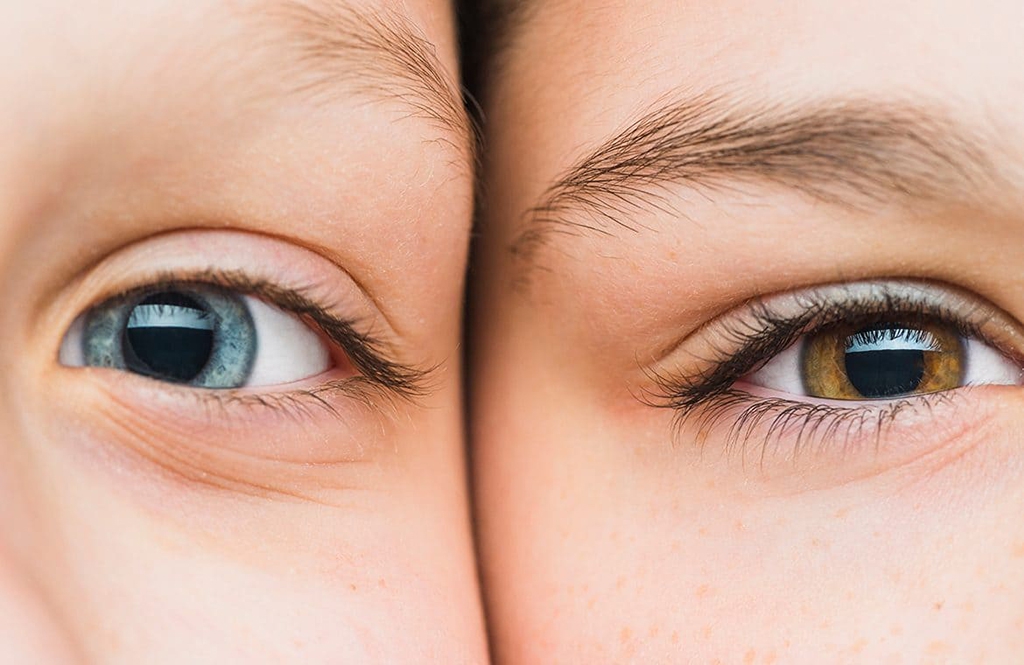 What are the causes of continuous eye twitching in the lower eyelid?