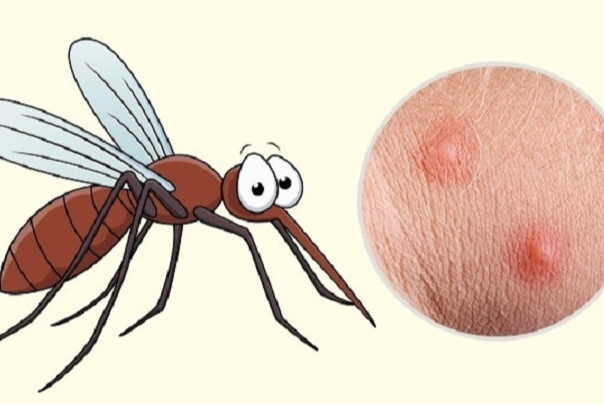 Tại sao muỗi đốt lại ngứa? Cách làm dịu vết muỗi đốt 2
