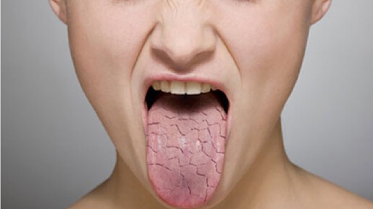 Cảm giác bị đắng miệng thường là biểu hiện của gì?
