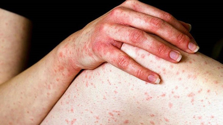 Tắm lá kim ngân có tác dụng gì​? Cách sử dụng hiệu quả 3