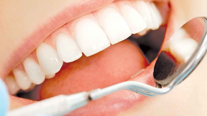 Tẩy trắng răng nhưng răng không đều màu: Nguyên nhân do đâu và cách khắc phục