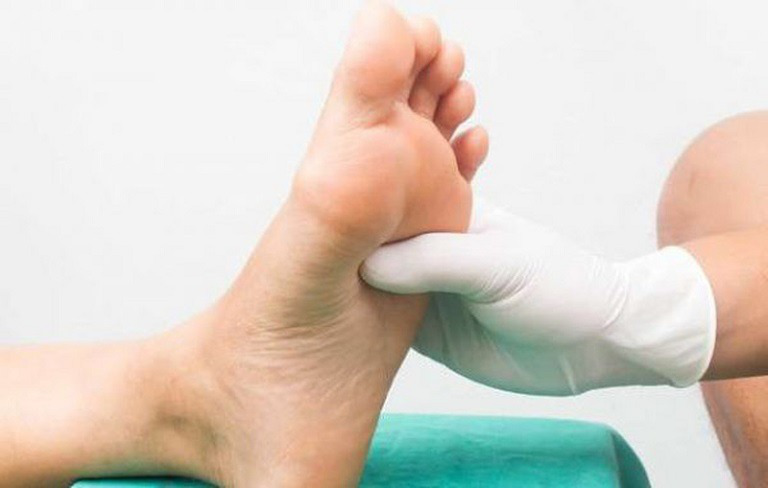 Tê lòng bàn chân: Nguyên nhân và cách điều trị hiệu quả 2