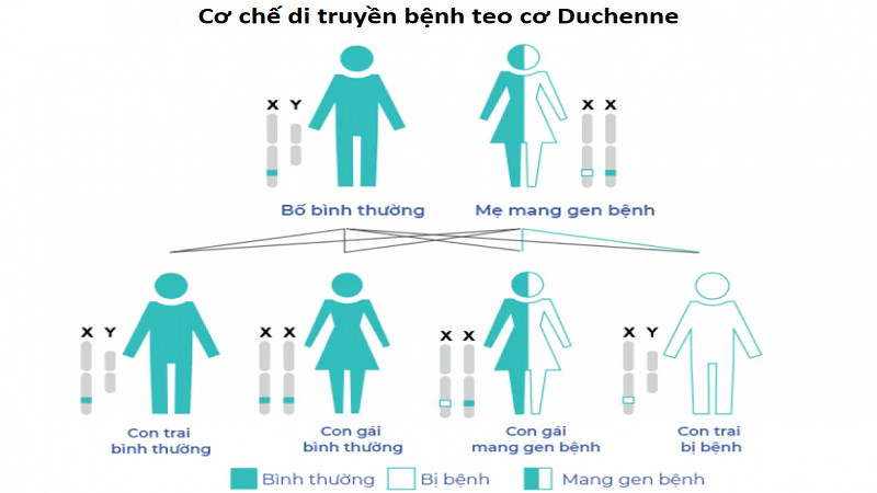 Teo cơ Duchenne: Dấu hiệu, nguyên nhân, chẩn đoán và điều trị 2