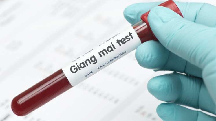 Test nhanh giang mai có chính xác không?