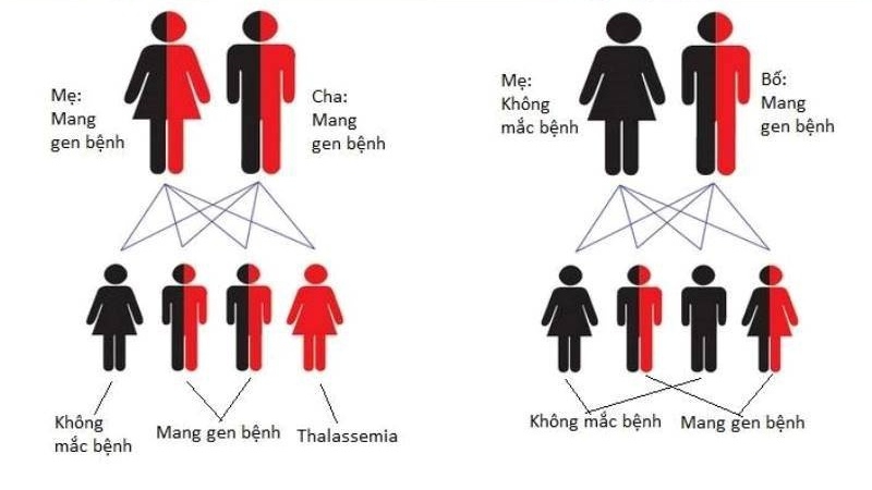thalassemia-di-truyen-la-benh-gi-thalassemia-co-chua-tri-duoc-khong 2