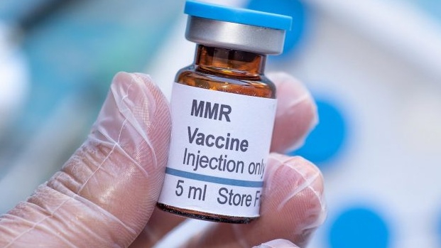 [THAM KHẢO] Chi phí tiêm sởi quai bị rubella bao nhiêu tiền?