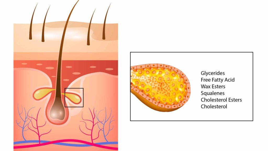 Vai trò của tuyến bã nhờn và một số vấn đề thường gặp ở tuyến bã nhờn