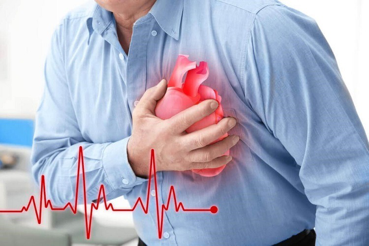 Thiếu máu cơ tim uống thuốc gì? Điều trị bệnh nhân thiếu máu cơ tim1