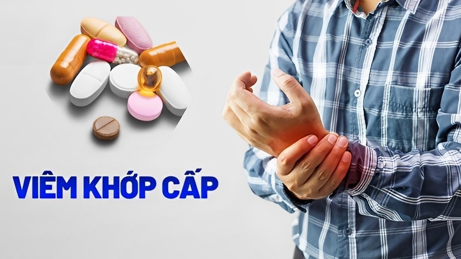 Thuốc điều trị viêm khớp cấp nào tốt?