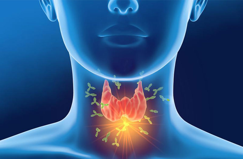 Thyroid là gì và những bệnh lý thường gặp 3